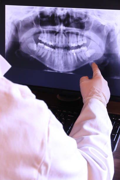 Best Emergency Gum Treatment in St Augustine Shores, FL
